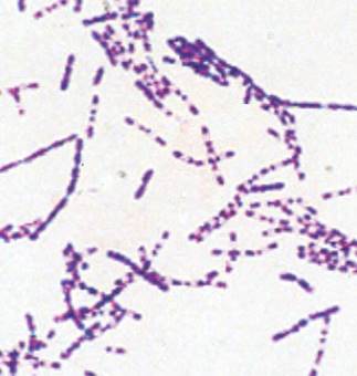 HERE IS YOUR BLOOD AGAR CULTURE